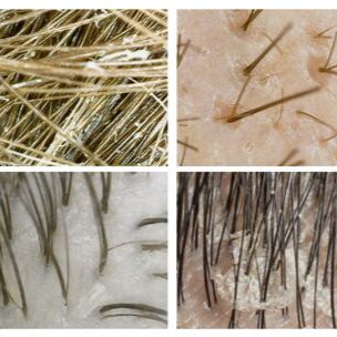 Digitální mikroskopická kamera