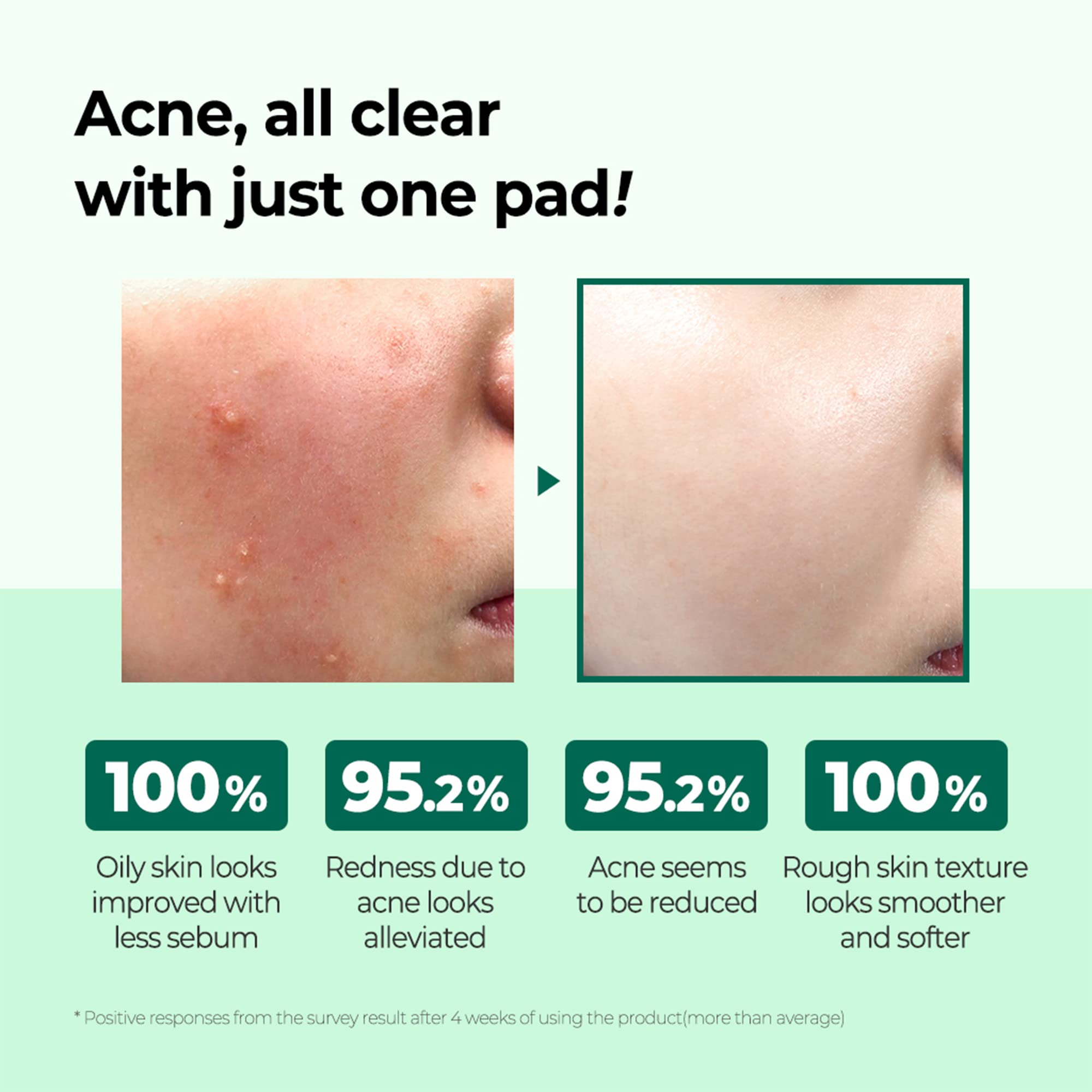 SOME BY MI - AHA, BHA, PHA 30 Days Miracle Truecica Clear Pad [70 pcs] - Cleansing pads with AHA, BHA, PHA and Truecica [70 pcs]