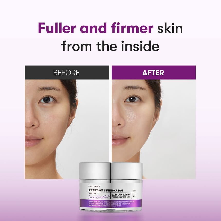 VT - Reedle Shot lifting cream enriched with microneedles - 50 ml